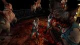 Bild 2 zu Silent Hill HD Collection