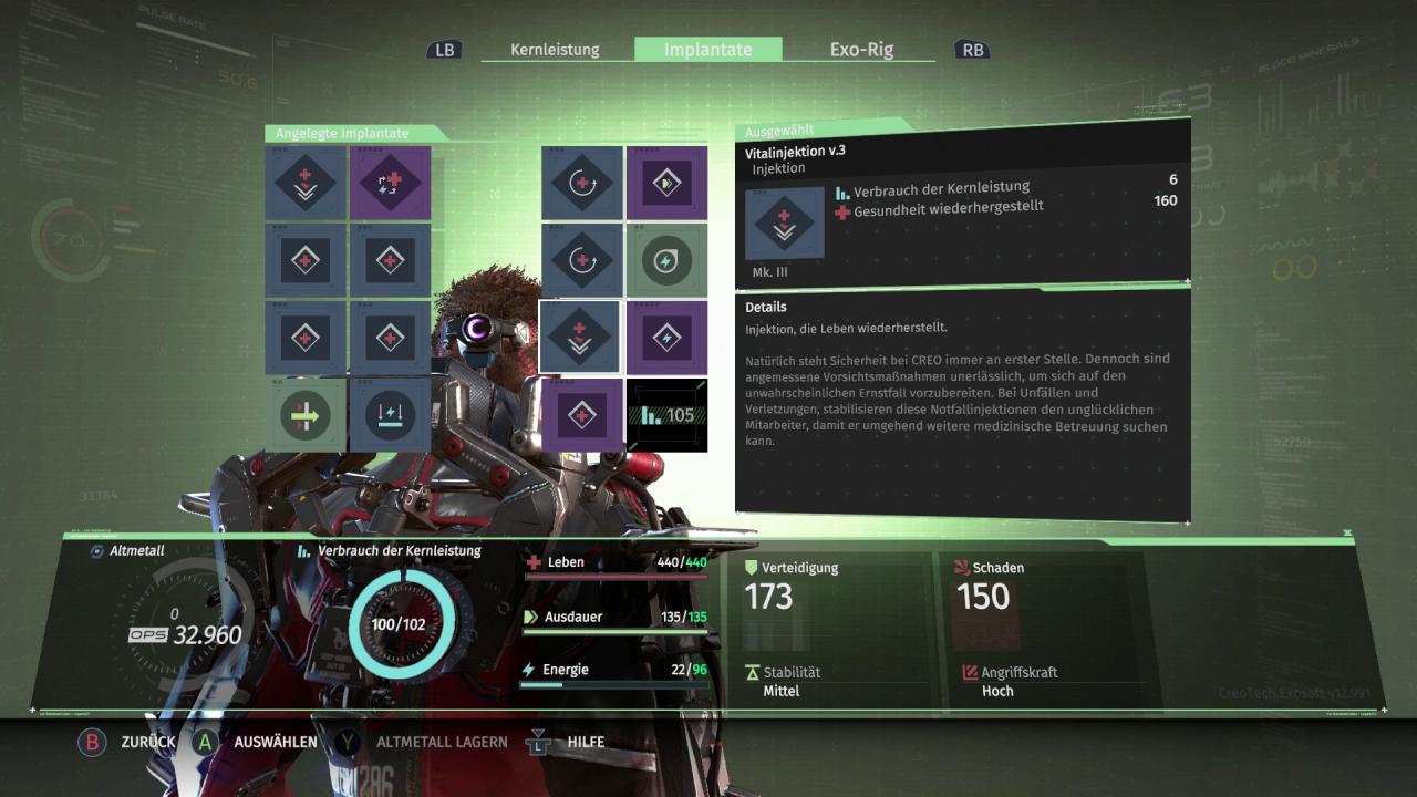[16/05/2017] Durch das simple, aber durchdachte Implantat-System können wir unseren Build blitzschnell ändern.
