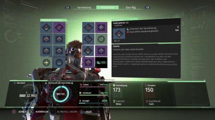 Durch das simple, aber durchdachte Implantat-System können wir unseren Build blitzschnell ändern.